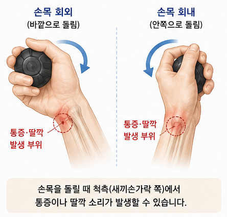 손목을 돌릴 때 척측 통증이 생기는 위치 그림